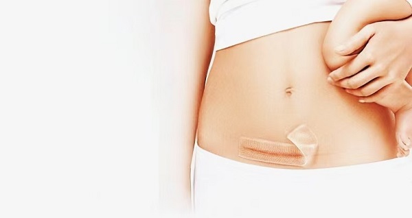 Защо дебелите листове за белези от силиконов гел са толкова популярни?