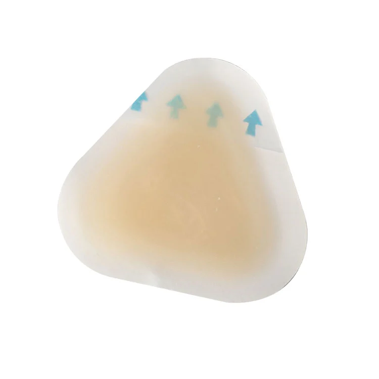 Предотвратяване на стерилни мехури по петите: Как можете да защитите краката си от болка, инфекция и увреждане от триене