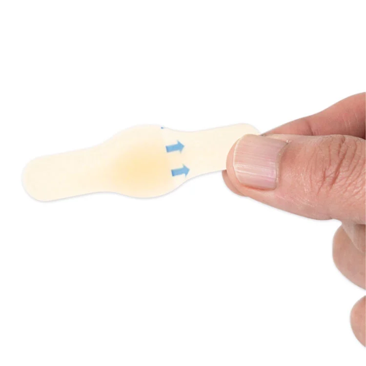 Усъвършенствани хидроколоидни превръзки за заздравяване на мехури